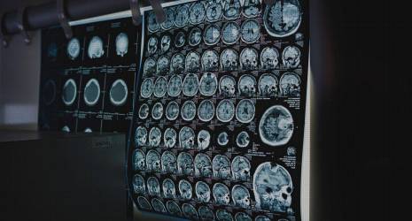 Avances tecnológicos en el análisis de la composición química de los jarrones de hierro